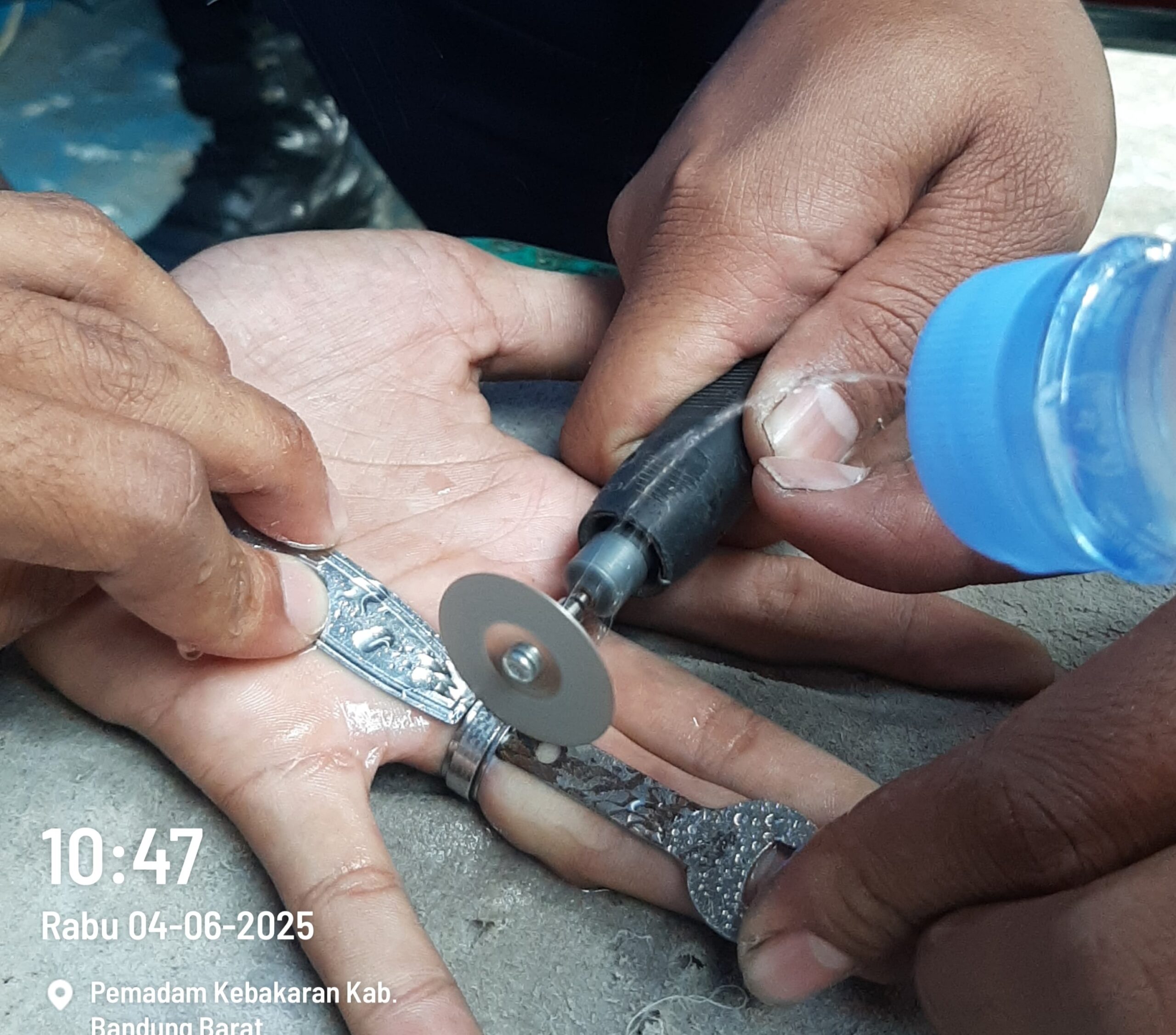 Damkar KBB Berhasil Evakuasi Cincin Terjepit di Jari Warga Cilame